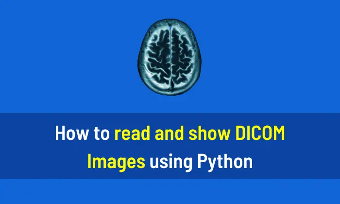 How to read and show DICOM Images using Python