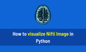 How to visualize Nifti Image in Python